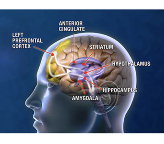 NeuroStar Advanced Therapy (TMS)